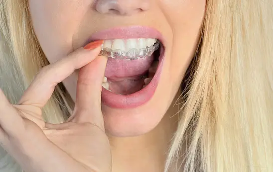 Whitening Of The Teeth Techniques To Try At Home